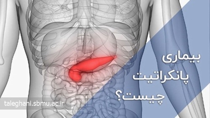 پانکراتیت (التهاب پانکراس) چیست و چگونه درمان می شود؟ 